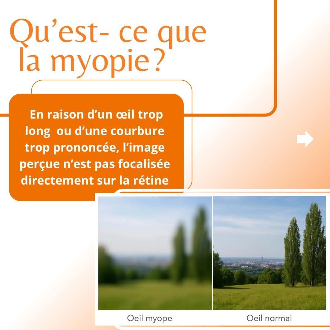 Lunetterie Zone Optique