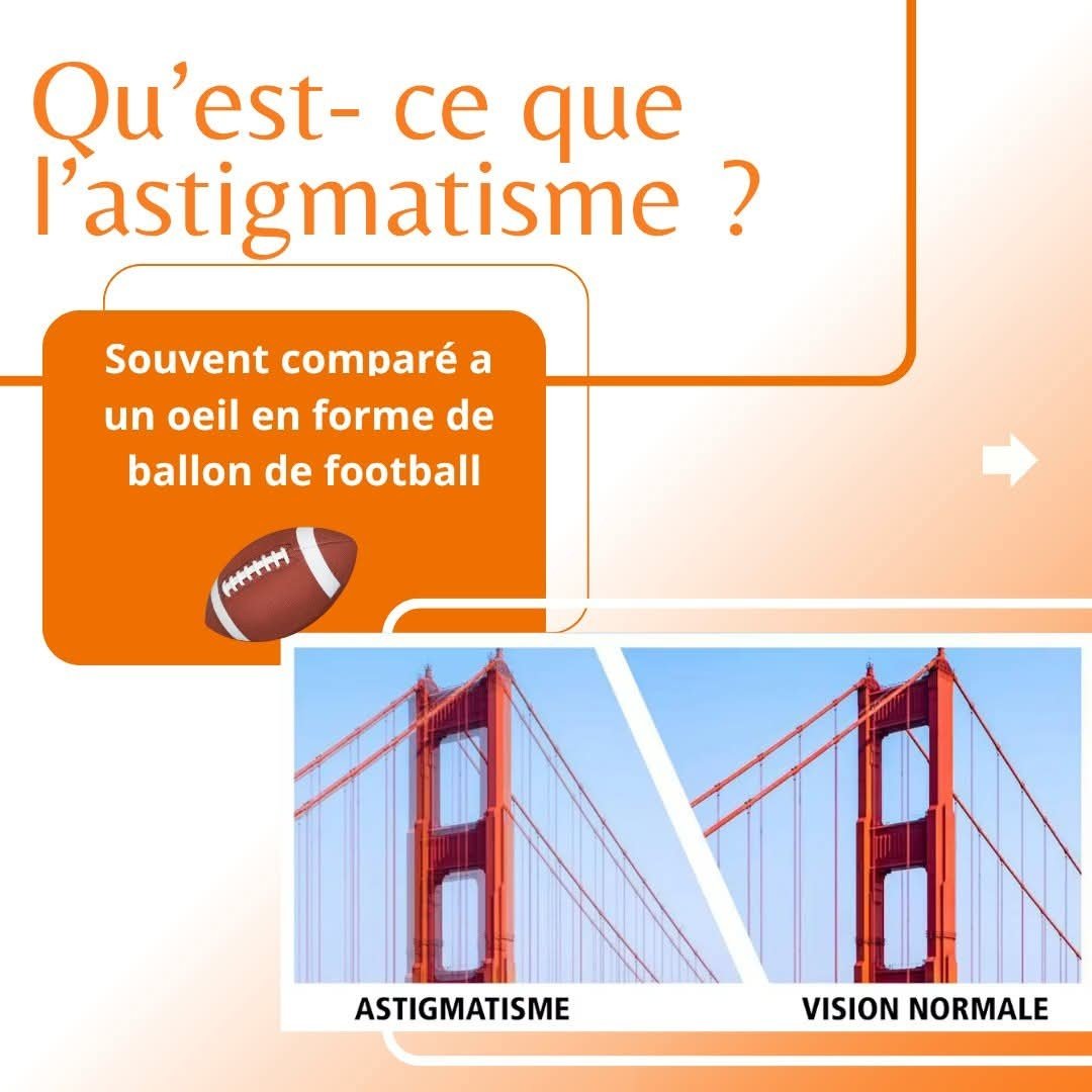Lunetterie Zone Optique